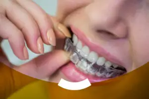 Lee más sobre el artículo Sonríe con confianza: descubre la ortodoncia invisible en Witizz